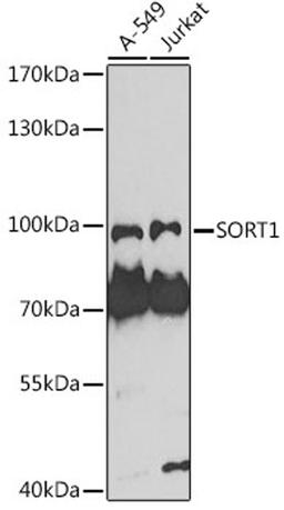 Western blot - SORT1 antibody (A7926)