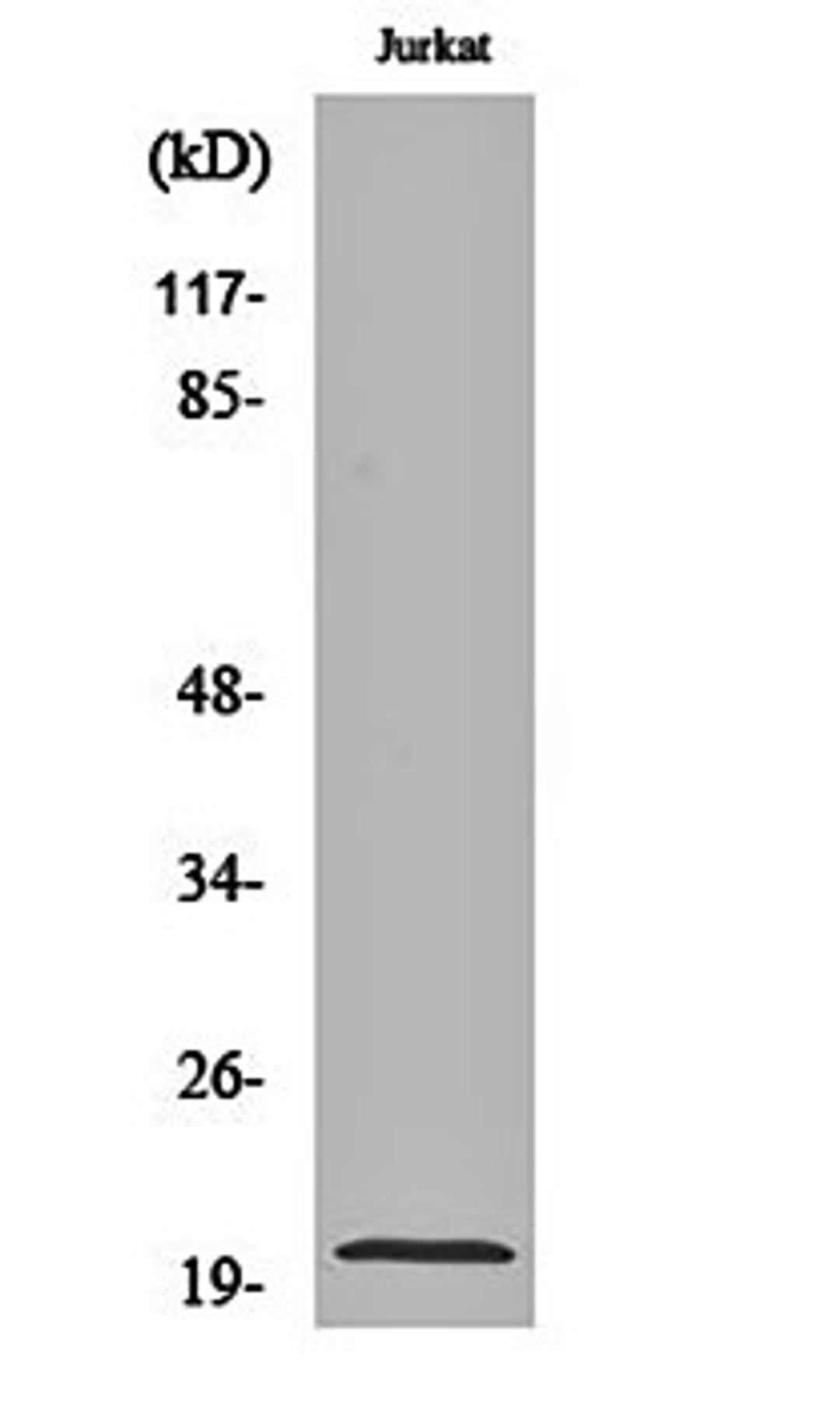 Western blot analysis of Jurkat cell lysates using MRP-L54 antibody