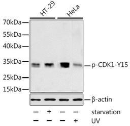 Western blot - Phospho-CDK1-Y15 antibody (AP0016)