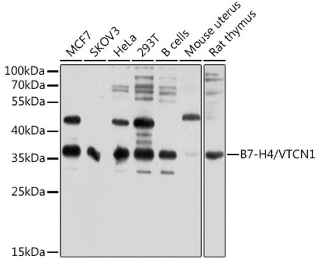 Western blot - B7-H4/VTCN1 antibody (A10412)