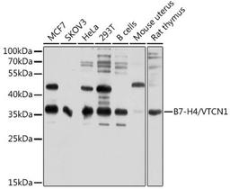 Western blot - B7-H4/VTCN1 antibody (A10412)