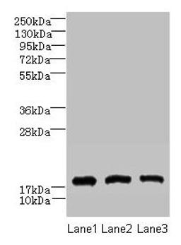 Western blot. All lanes: CNIH2 antibody at 2µg/ml. Lane 1: U251 whole cell lysate. Lane 2: Mouse liver tissue. Lane 3: Mouse kidney tissue. Secondary. Goat polyclonal to rabbit IgG at 1/10000 dilution. Predicted band size: 19 kDa. Observed band size: 19 kDa