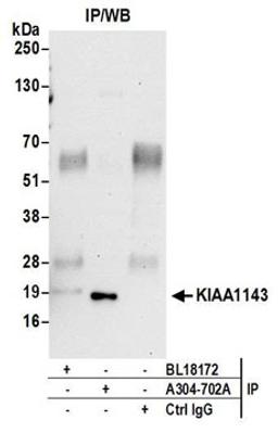 Detection of human KIAA1143 by western blot of immunoprecipitates.