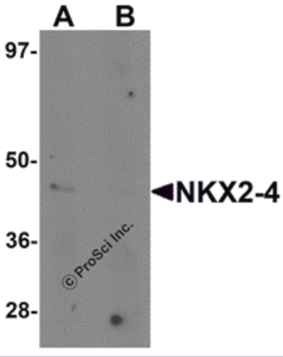 Western blot analysis of NKX2-4 in A20 cell lysate with NKX2-4 antibody at 1 μg/mL in (A) the absence and (B) the presence of blocking peptide.