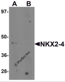 Western blot analysis of NKX2-4 in A20 cell lysate with NKX2-4 antibody at 1 μg/mL in (A) the absence and (B) the presence of blocking peptide.