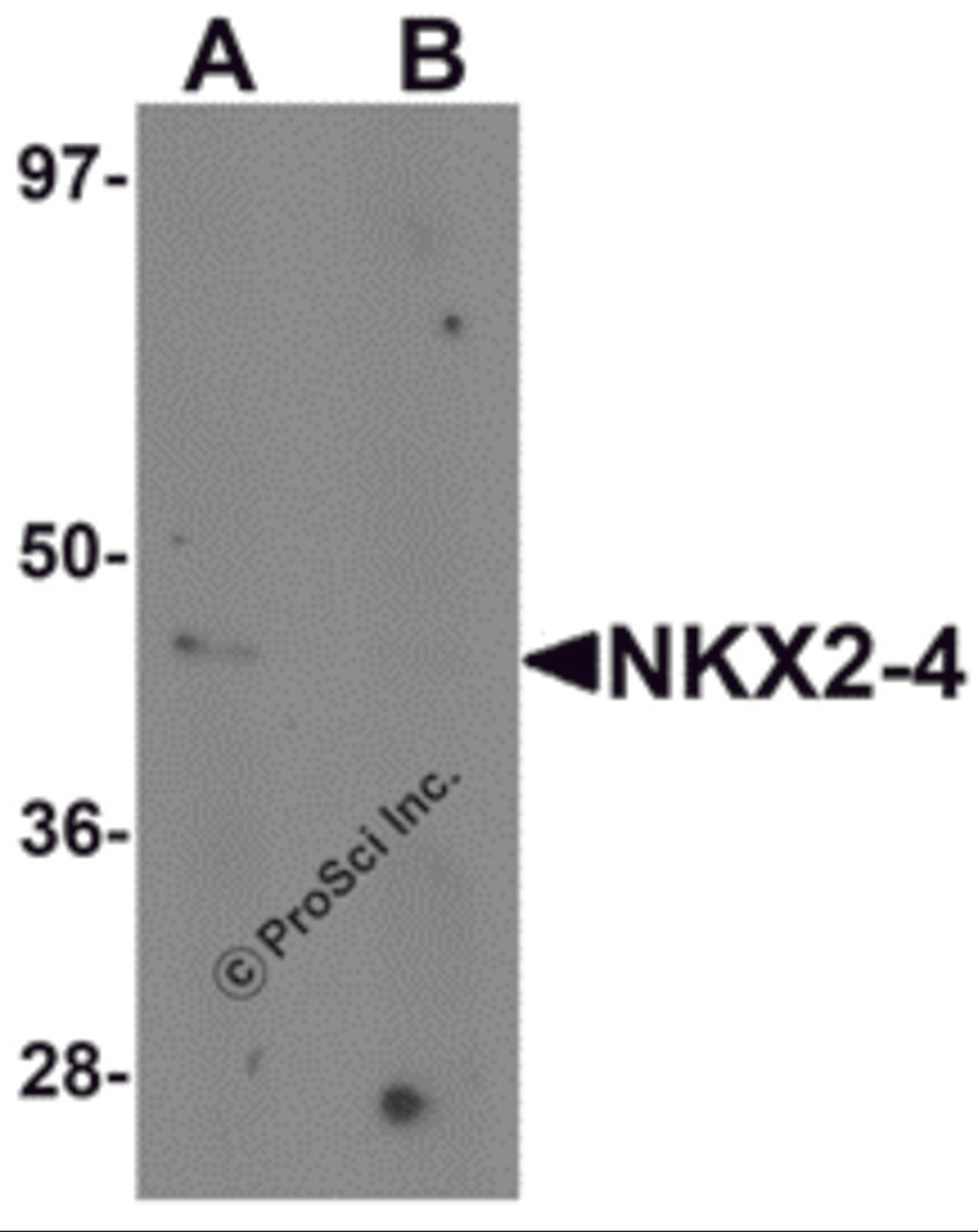 Western blot analysis of NKX2-4 in A20 cell lysate with NKX2-4 antibody at 1 μg/mL in (A) the absence and (B) the presence of blocking peptide.