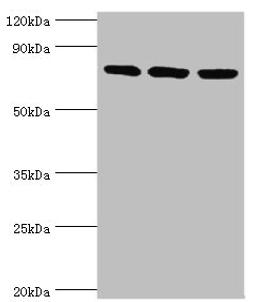 Western blot. All lanes: DNA replication licensing factor MCM5 antibody at 3ug/ml. Lane 1: Hela whole cell lysate. Lane 2: MCF-7 whole cell lysate. Lane 2: Mouse thymus tissue. Secondary. Goat polyclonal to rabbit IgG at 1/10000 dilution. Predicted band size: 82 kDa. Observed band size: 82 kDa. 