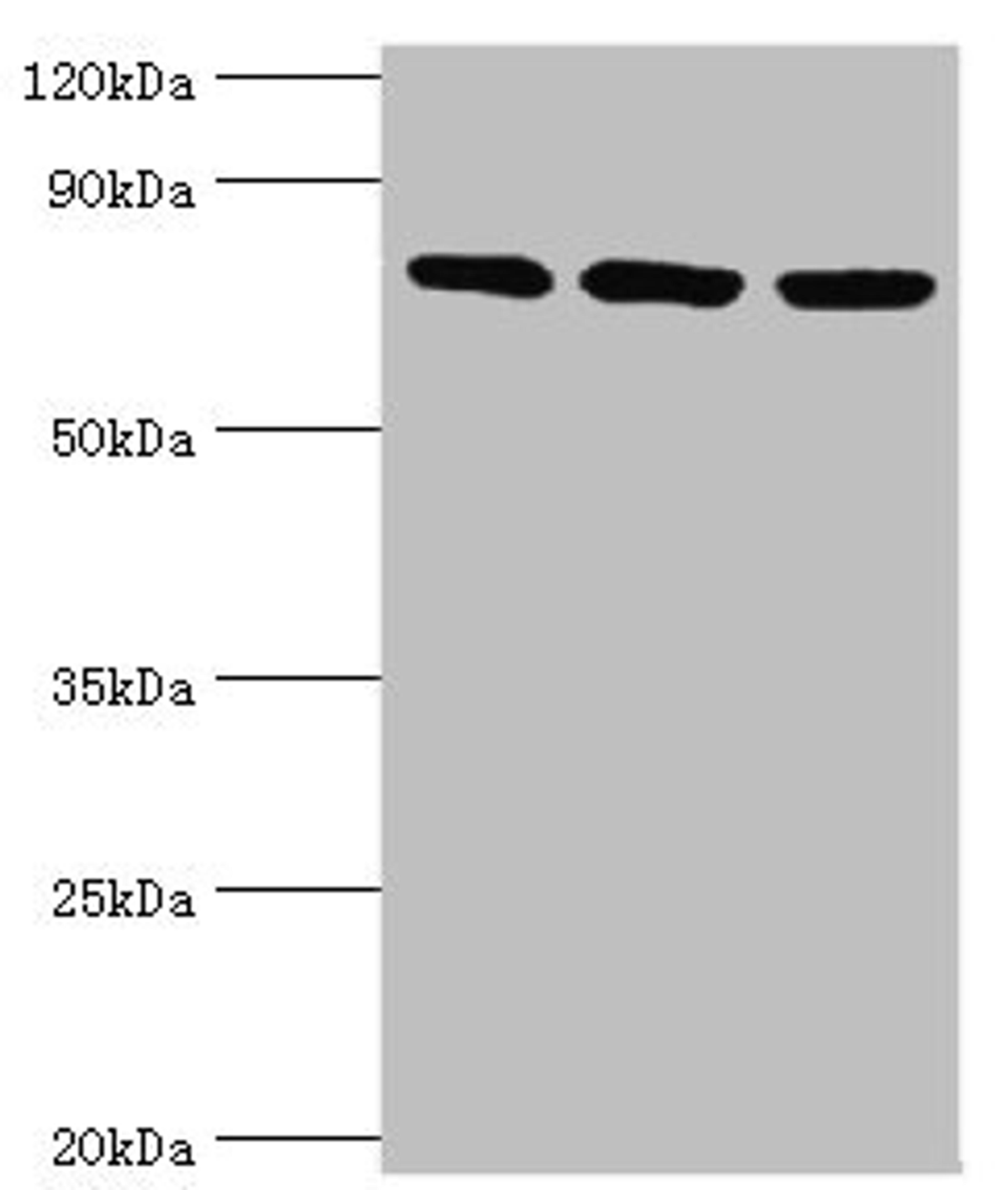 Western blot. All lanes: DNA replication licensing factor MCM5 antibody at 3ug/ml. Lane 1: Hela whole cell lysate. Lane 2: MCF-7 whole cell lysate. Lane 2: Mouse thymus tissue. Secondary. Goat polyclonal to rabbit IgG at 1/10000 dilution. Predicted band size: 82 kDa. Observed band size: 82 kDa. 
