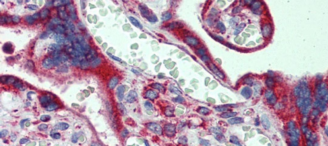 Antibody used in IHC on Human Placenta at 5.0 ug/ml.