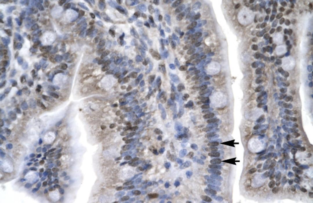 Antibody used in IHC on Human Intestine.