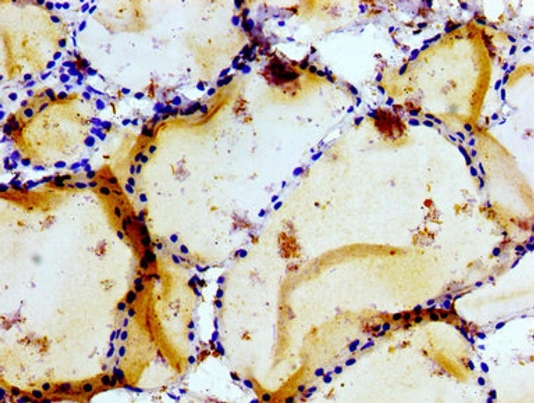 Immunohistochemistry of paraffin-embedded human thyroid tissue using CSB-PA009906LA01HU at dilution of 1:100
