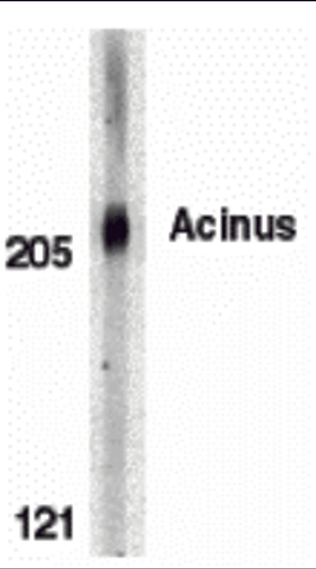 Western blot analysis of Acinus in K562 whole cell lysate with Acinus antibody at 0.5 μg/mL.