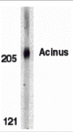 Western blot analysis of Acinus in K562 whole cell lysate with Acinus antibody at 0.5 μg/mL.