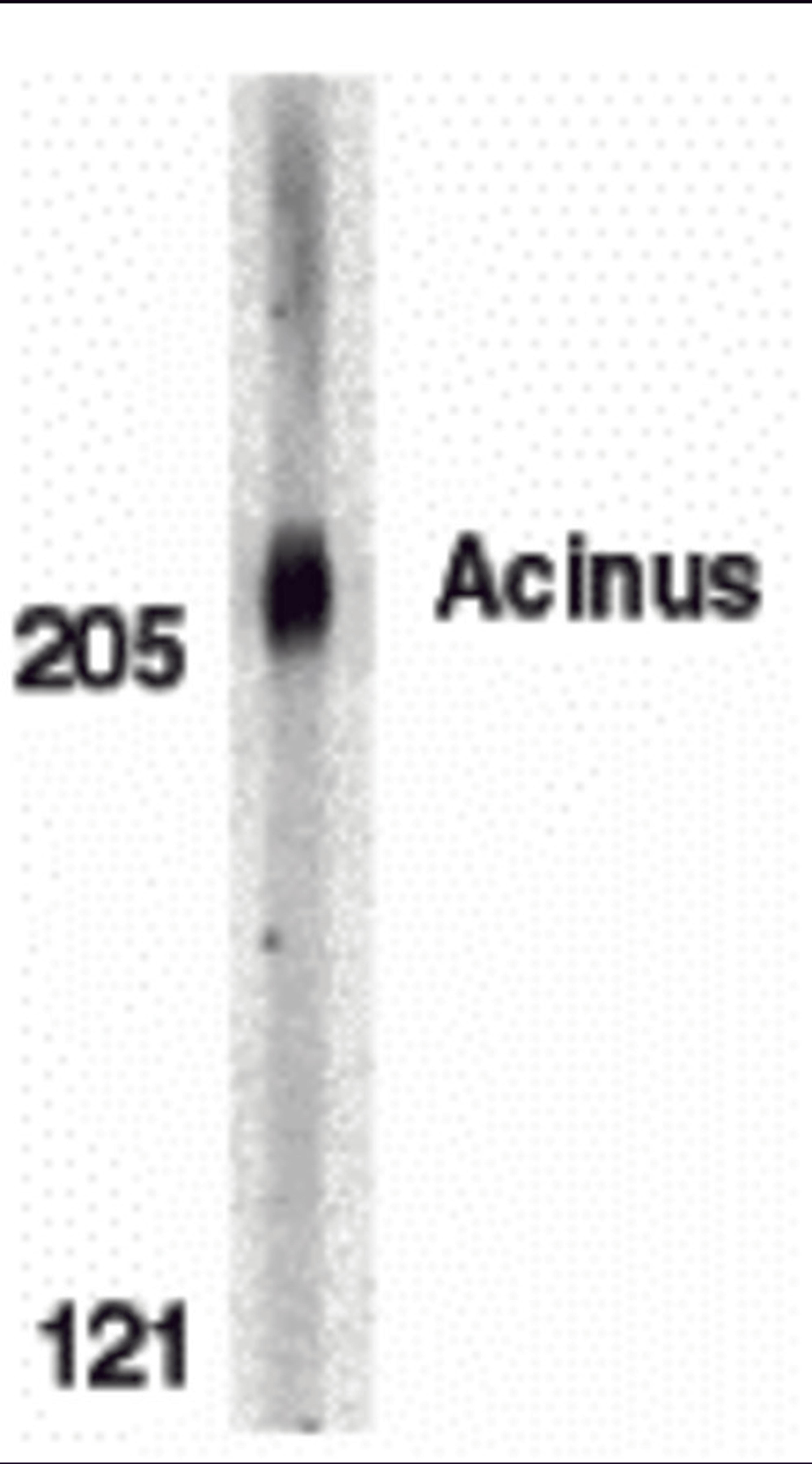 Western blot analysis of Acinus in K562 whole cell lysate with Acinus antibody at 0.5 μg/mL.