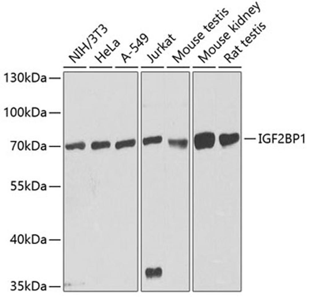 Western blot - IGF2BP1 antibody (A1517)