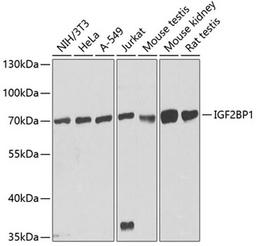 Western blot - IGF2BP1 antibody (A1517)