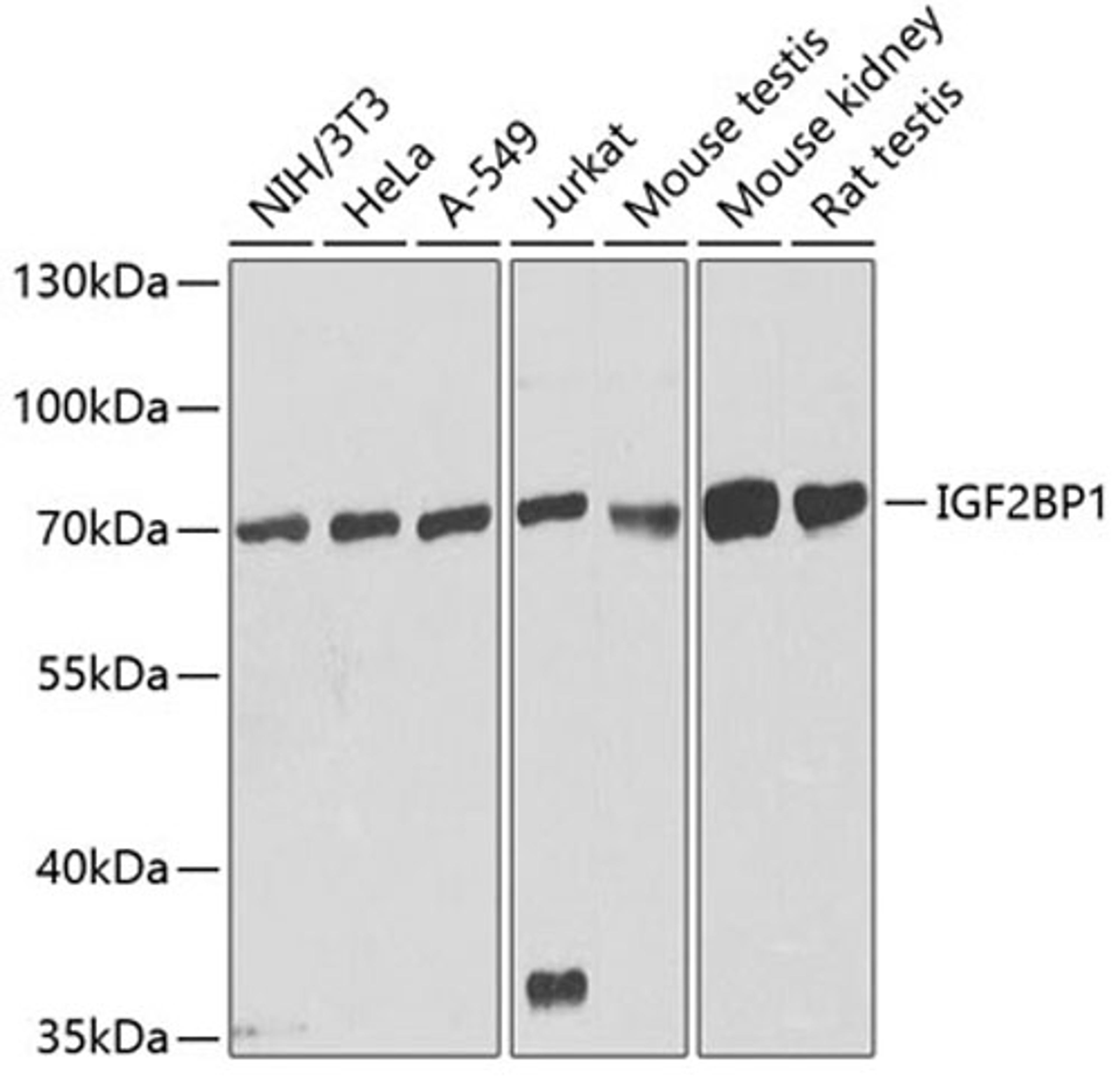 Western blot - IGF2BP1 antibody (A1517)