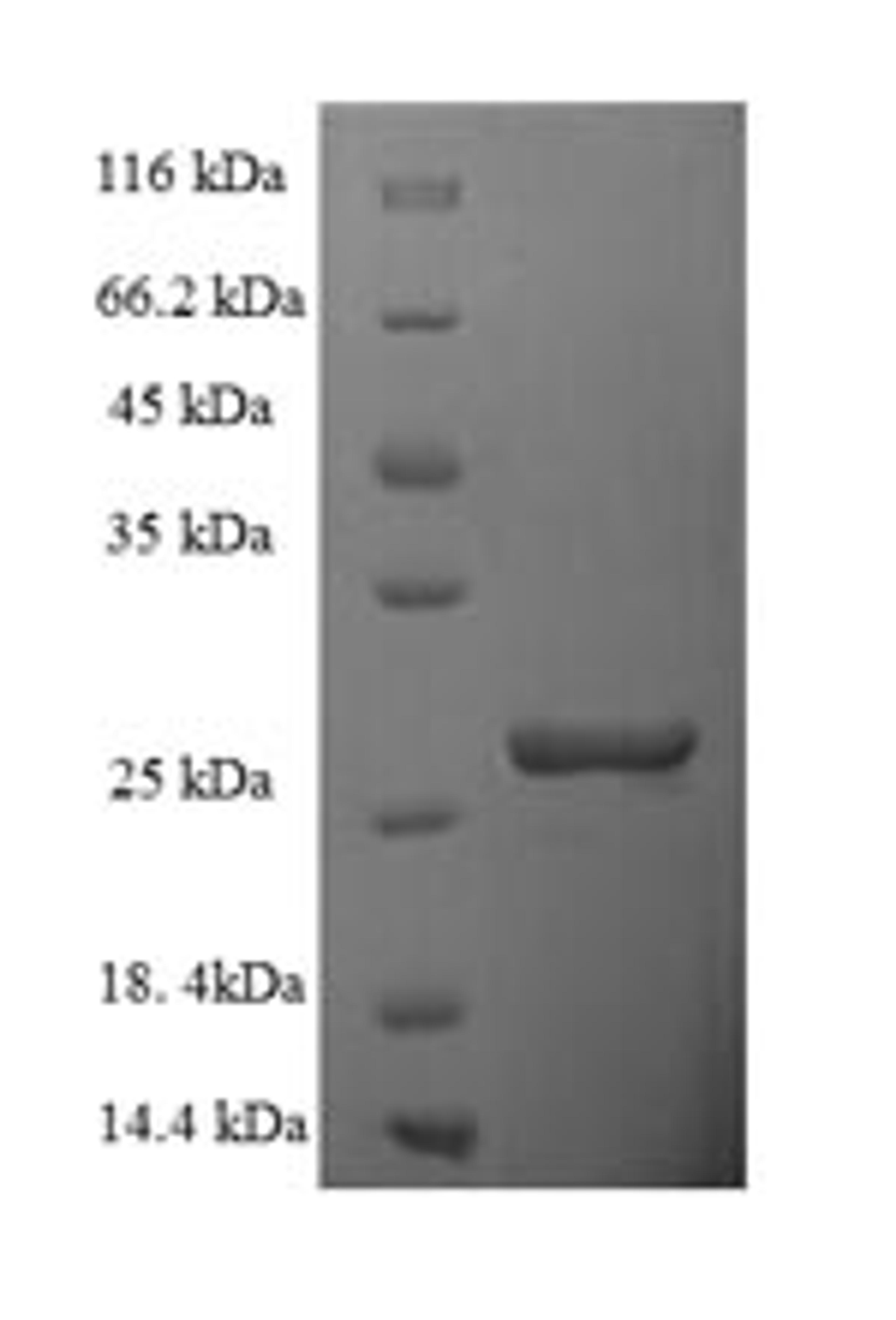 (Tris-Glycine gel) Discontinuous SDS-PAGE (reduced) with 5% enrichment gel and 15% separation gel.