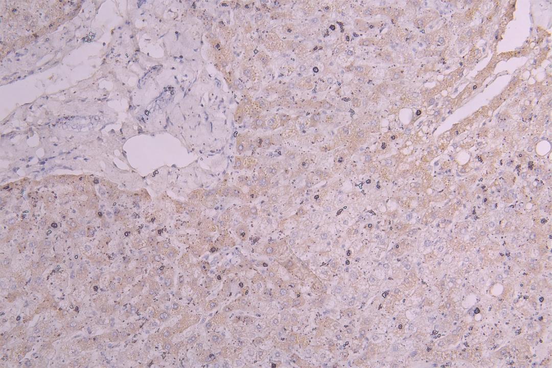 IHC image of CSB-RA010144MA1HU diluted at 1:300 and staining in paraffin-embedded human liver tissue performed on a Leica BondTM system. After dewaxing and hydration, antigen retrieval was mediated by high pressure in a citrate buffer (pH 6.0). Section was blocked with 10% normal goat serum 30min at RT. Then primary antibody (1% BSA) was incubated at 4°C overnight. The primary is detected by a Goat anti-Human IgG labeled by HRP and visualized using 0.05% DAB.