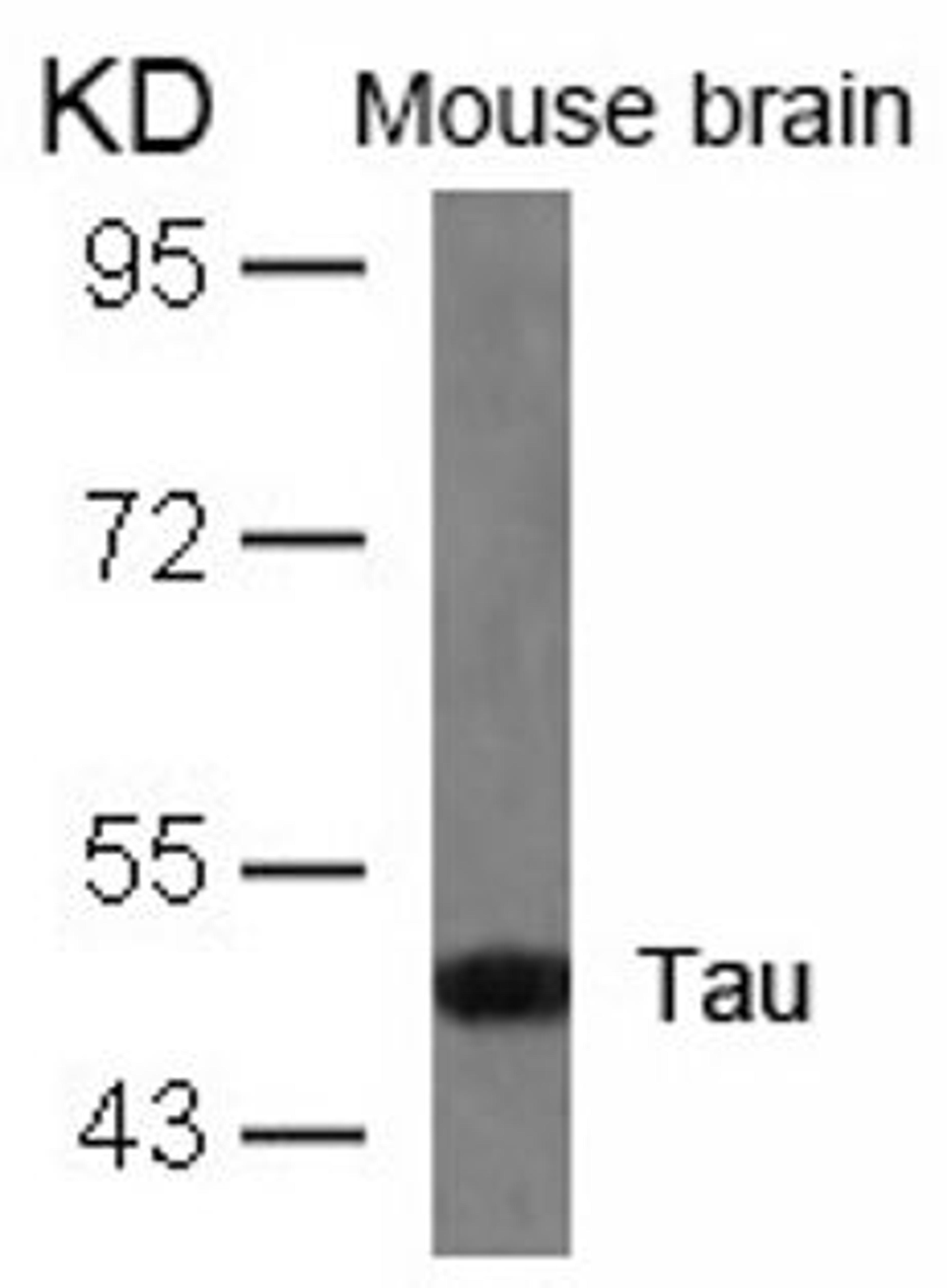 Western blot analysis of lysed extracts from mouse brain tissue using Tau (Ab-404).