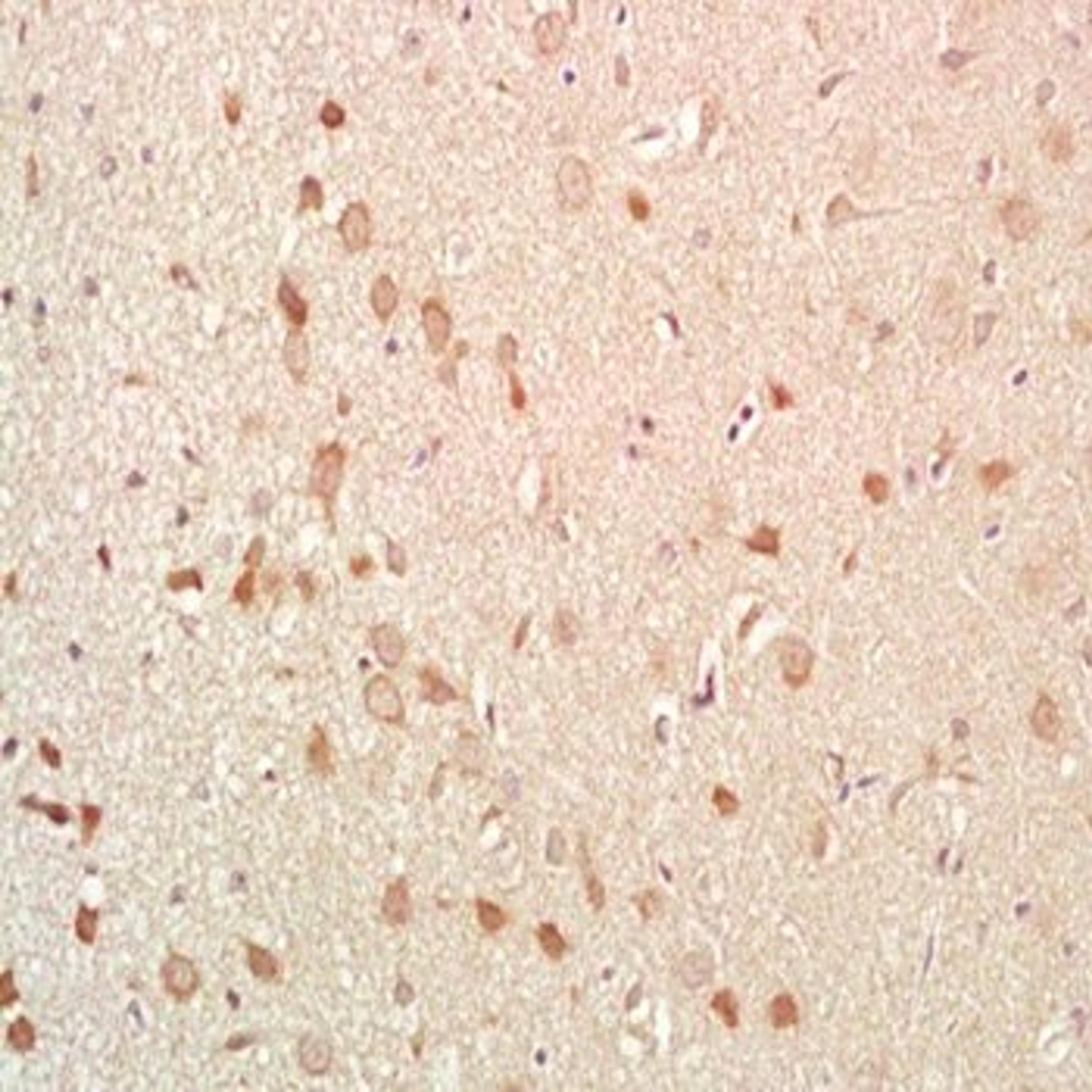 Immunohistochemical analysis of formalin-fixed paraffin embedded rat brain tissue using Neurokinin B antibody