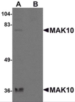 Western blot analysis of MAK10 in rat heart tissue lysate with MAK10 antibody at 1 μg/mL in the (A) absence and (B) presence of blocking peptide.