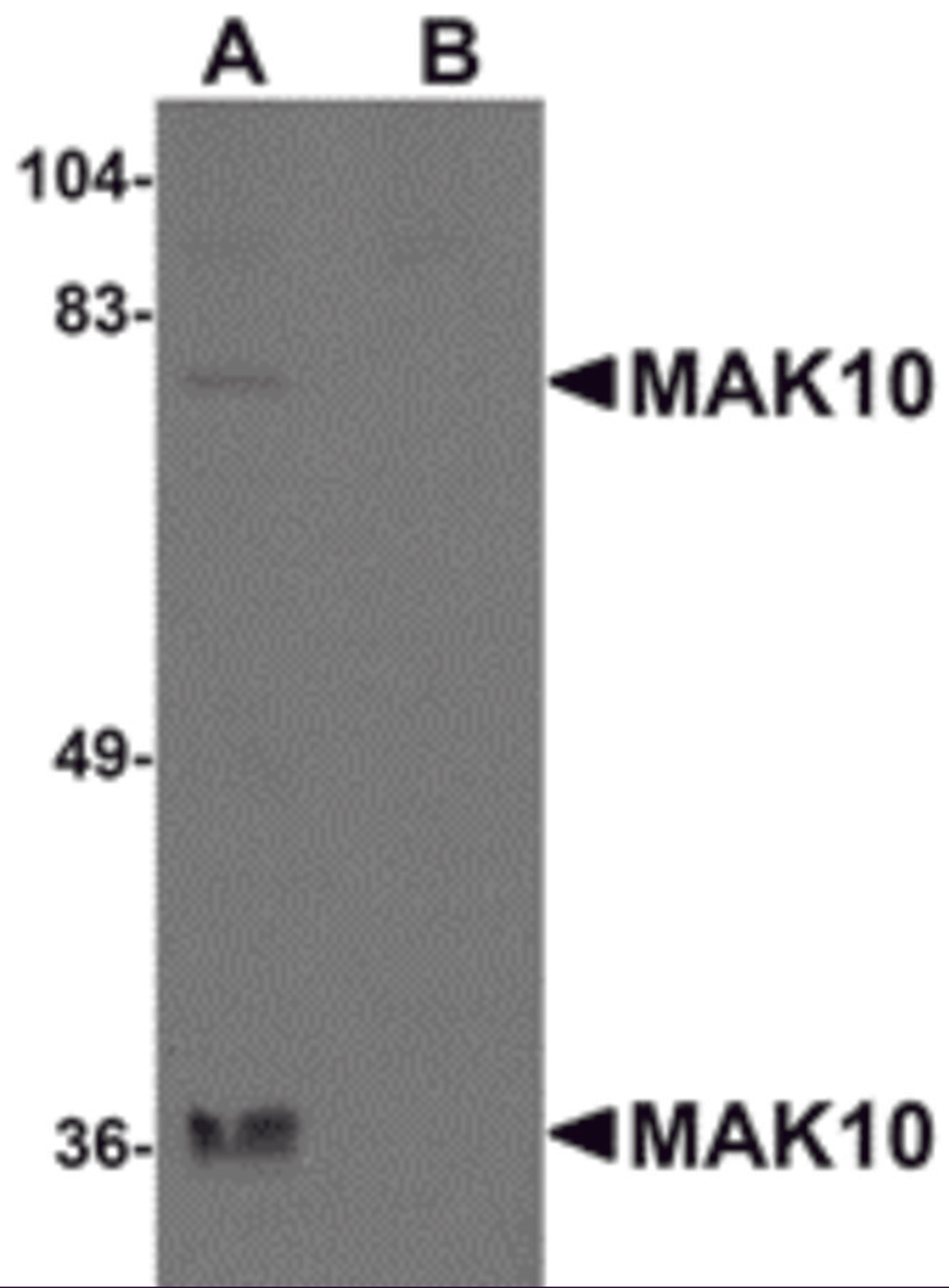 Western blot analysis of MAK10 in rat heart tissue lysate with MAK10 antibody at 1 μg/mL in the (A) absence and (B) presence of blocking peptide.
