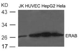 Western blot analysis of extract from JK, HUVEC, HepG2 and HeLa cells using ERAB Antibody.