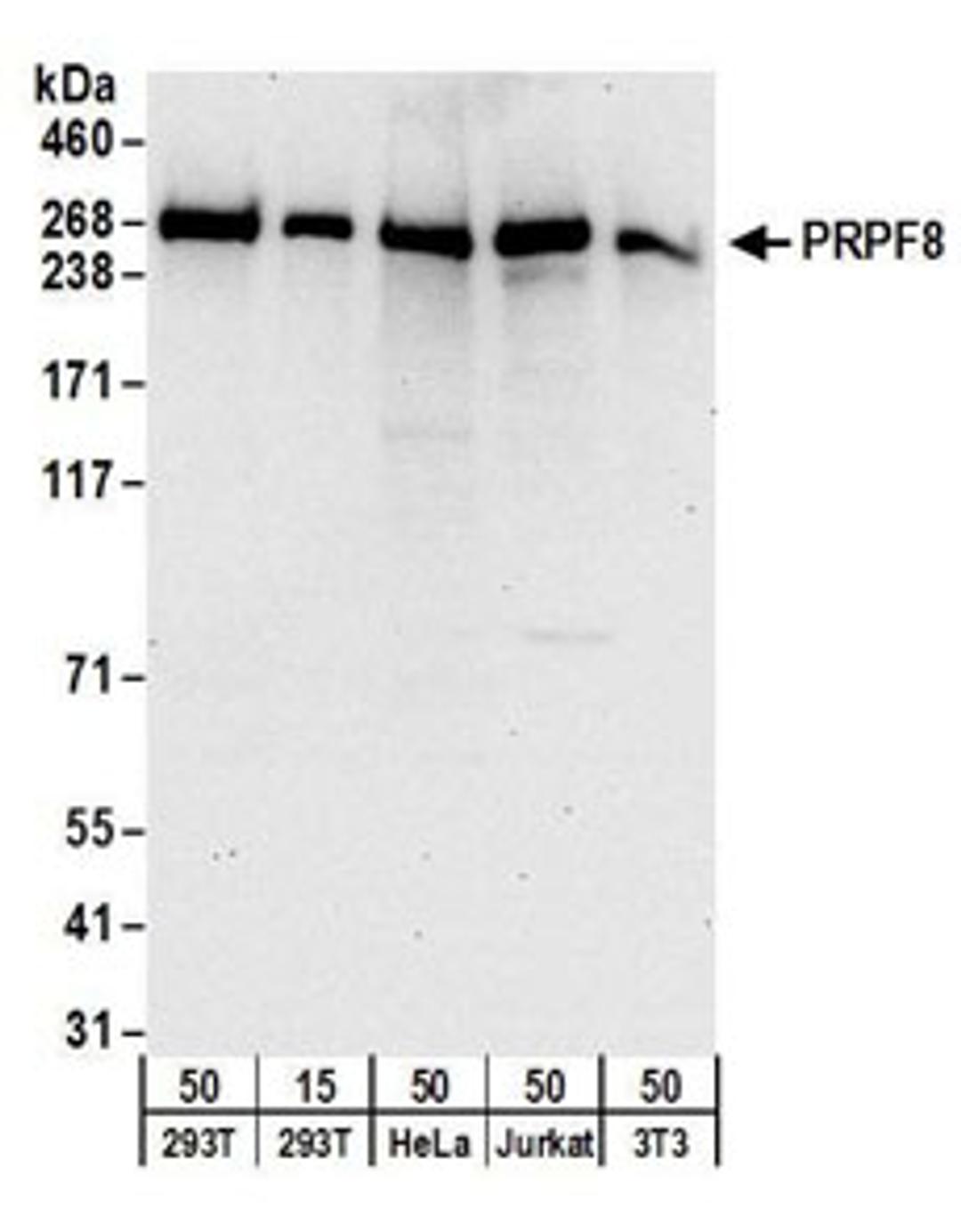 Detection of human and mouse PRPF8 by western blot.