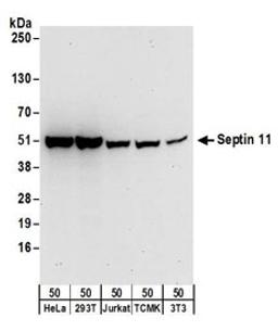 Detection of human and mouse Septin 11 by western blot.