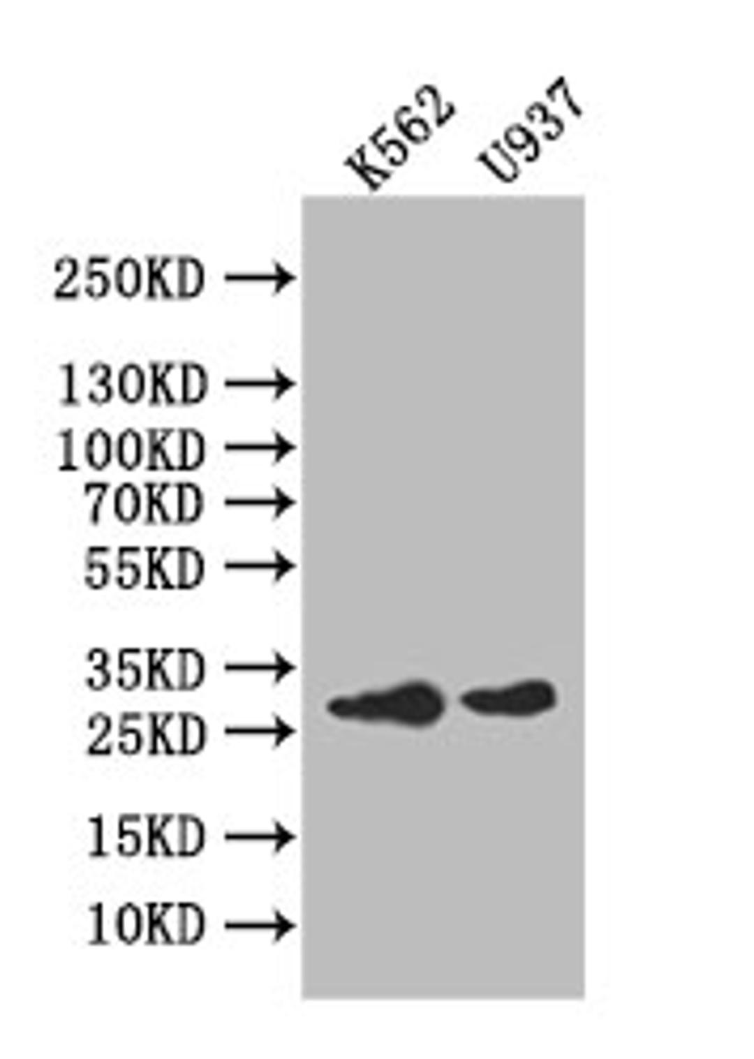Western Blot. Positive WB detected in: K562 whole cell lysate,U937 whole cell lysate. All lanes: Ikaros antibody at 1:1000. Secondary. Goat polyclonal to rabbit IgG at 1/50000 dilution. Predicted band size: 28 kDa. Observed band size: 28 kDa.