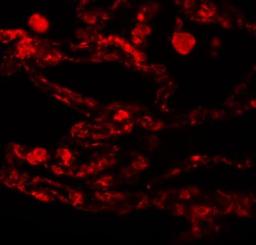 Immunocytochemistry/Immunofluorescence: CCDC69 Antibody [NBP1-77145] - Immunofluorescence of CCDC69 in human lung tissue with CCDC69 antibody at 20 ug/mL.