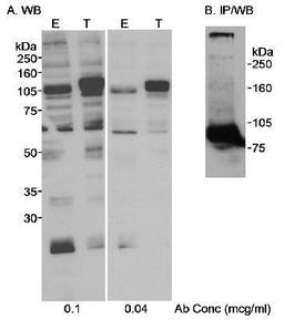 Western Blot: SP1 Antibody [NB600-232] - Detection of Human SP1 on HeLa whole cell lysate using NB600-232. Subsequently, NB600-232 was used at 0.04 mcg/ml for WB.