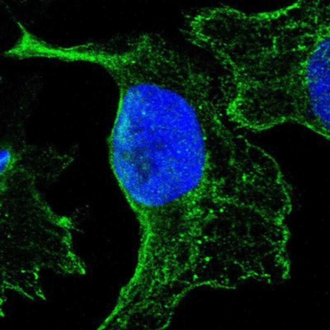 Immunocytochemistry/Immunofluorescence: ALDH9A1 Antibody [NBP1-89150] - Staining of human cell line U-2 OS shows positivity in plasma membrane.