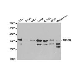 Western blot analysis of cell and tissue lysates using Rabbit anti TRADD antibody