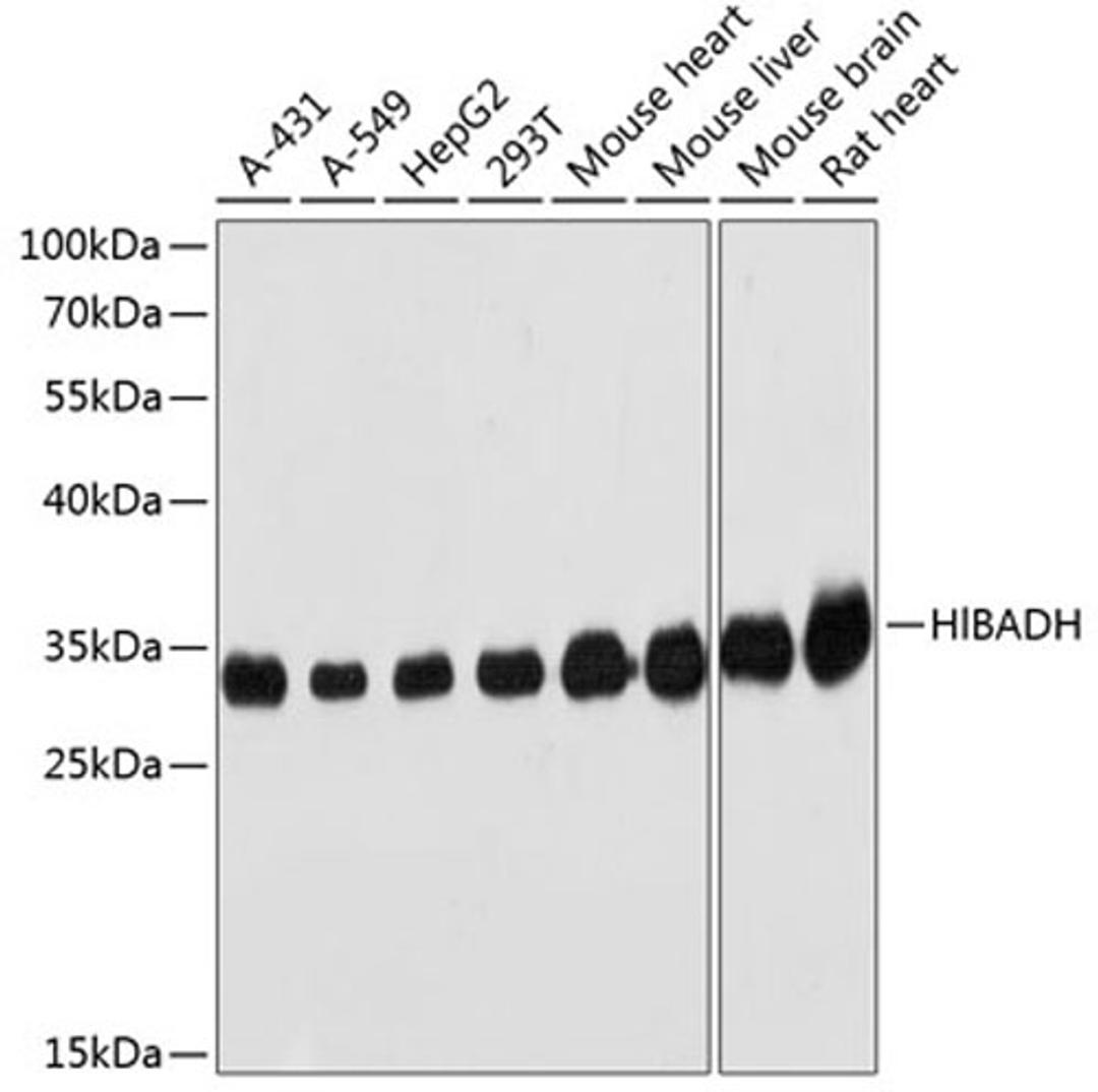 Western blot - HIBADH antibody (A1264)