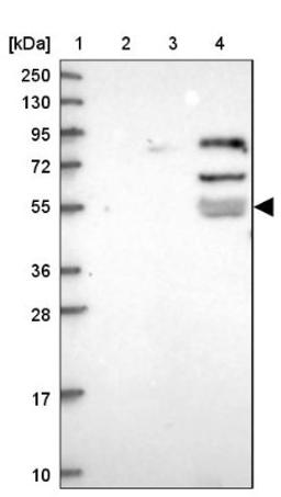 Western Blot: Peptidase inhibitor 16 Antibody [NBP1-92254] - Lane 1: Marker [kDa] 250, 130, 95, 72, 55, 36, 28, 17, 10<br/>Lane 2: Human cell line RT-4<br/>Lane 3: Human cell line U-251MG sp<br/>Lane 4: Human plasma (IgG/HSA depleted)