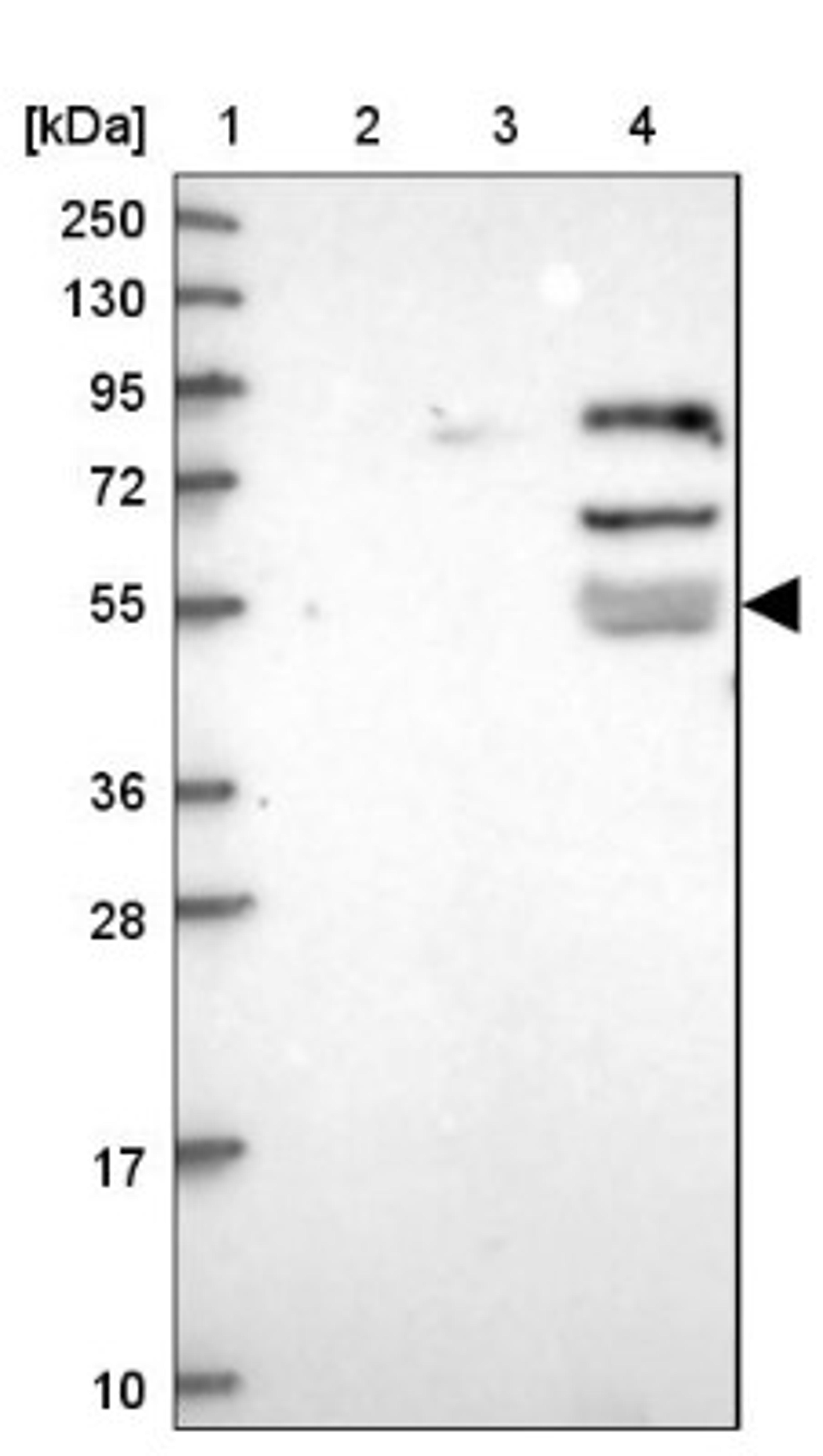 Western Blot: Peptidase inhibitor 16 Antibody [NBP1-92254] - Lane 1: Marker [kDa] 250, 130, 95, 72, 55, 36, 28, 17, 10<br/>Lane 2: Human cell line RT-4<br/>Lane 3: Human cell line U-251MG sp<br/>Lane 4: Human plasma (IgG/HSA depleted)