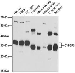 Western blot - CYB5R3 antibody (A7535)