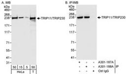 Detection of human TRIP11/TRIP230 by western blot and immunoprecipitation.