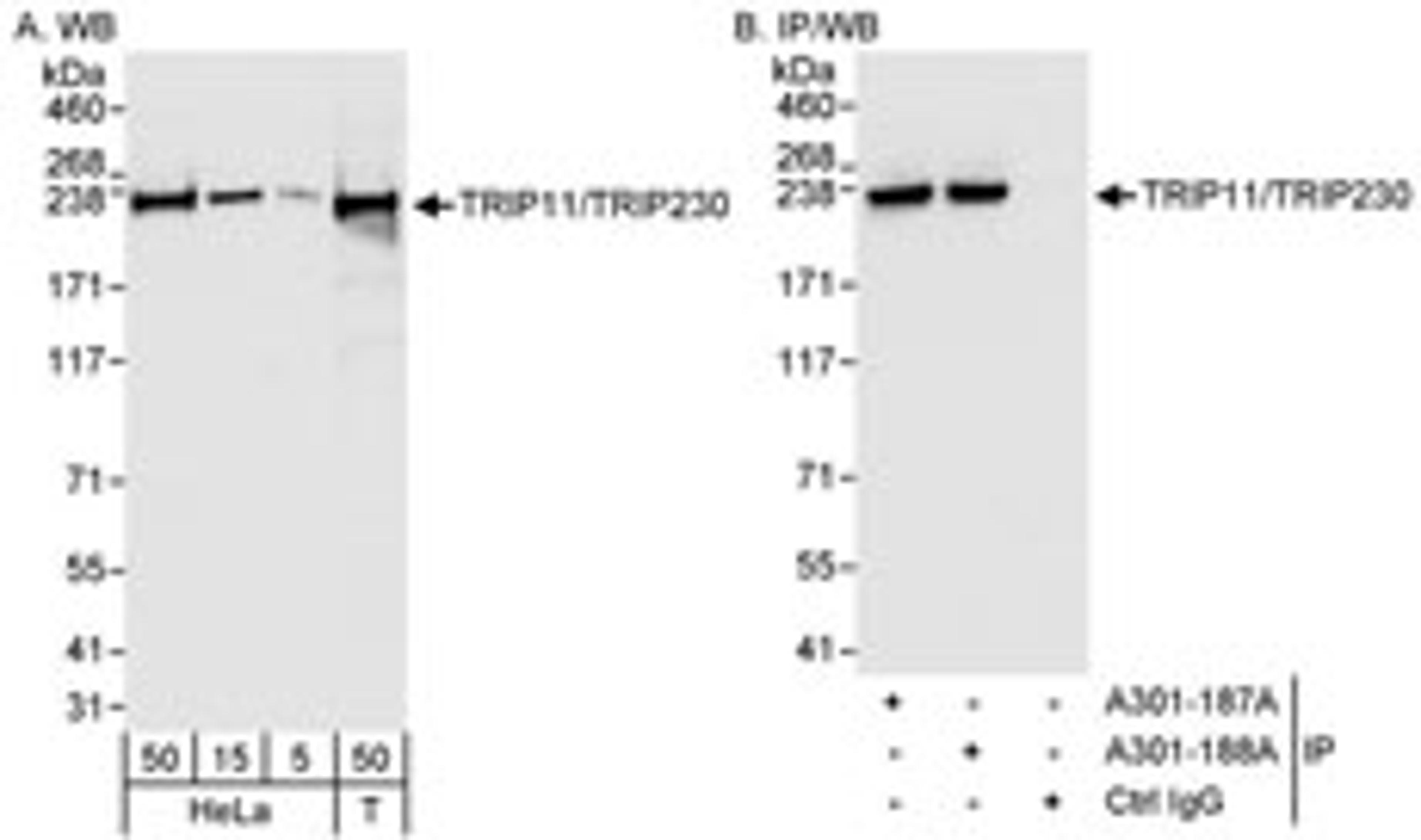 Detection of human TRIP11/TRIP230 by western blot and immunoprecipitation.