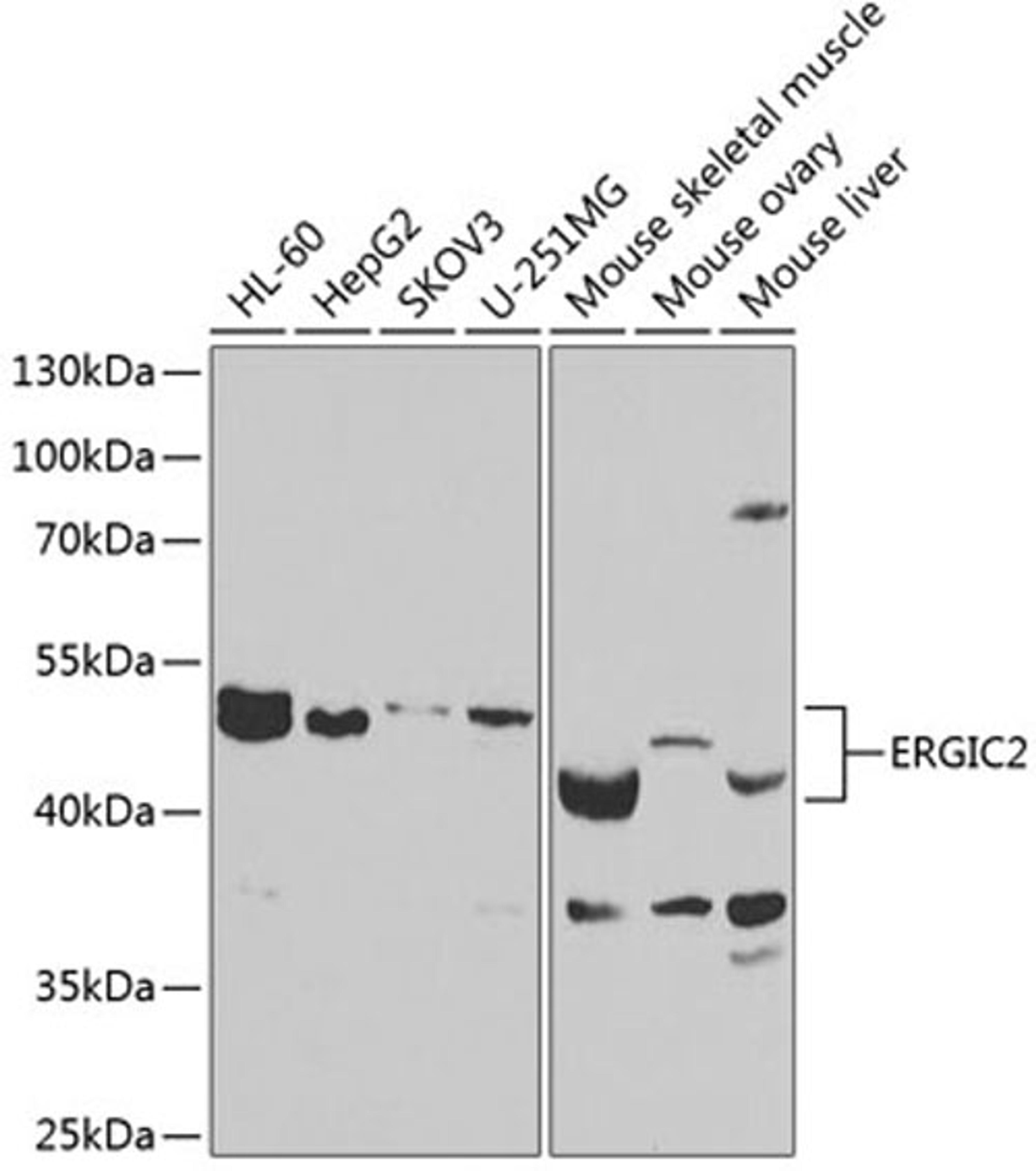 Western blot - ERGIC2 antibody (A7369)