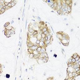 Immunohistochemical staining of mouse stomach tissue using IER3 antibody (dilution of 1:100)