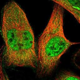 Immunocytochemistry/Immunofluorescence: ETAA1 Antibody [NBP1-90473] - Staining of human cell line U-2 OS shows positivity in nucleus but not nucleoli & cytoplasm.