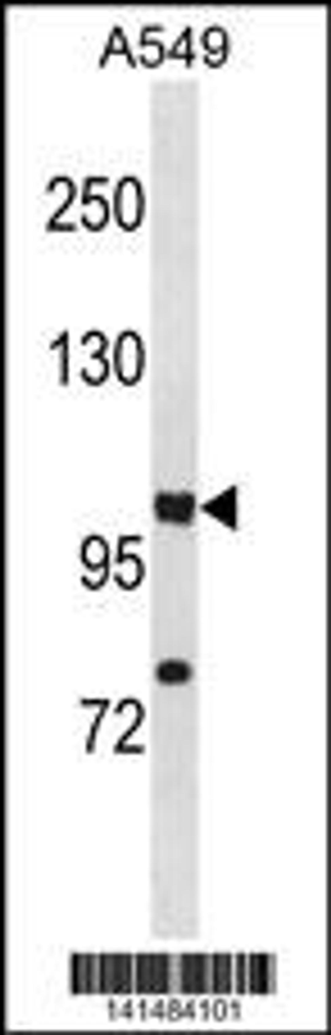 Western blot analysis in A549 cell line lysates (35ug/lane).