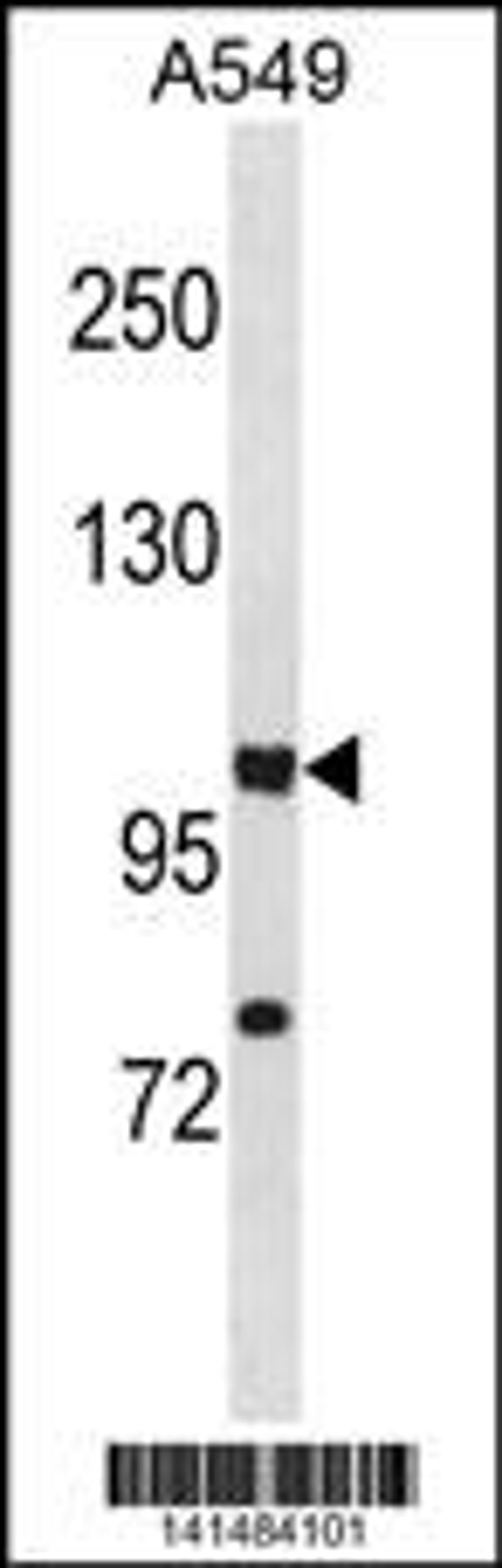 Western blot analysis in A549 cell line lysates (35ug/lane).