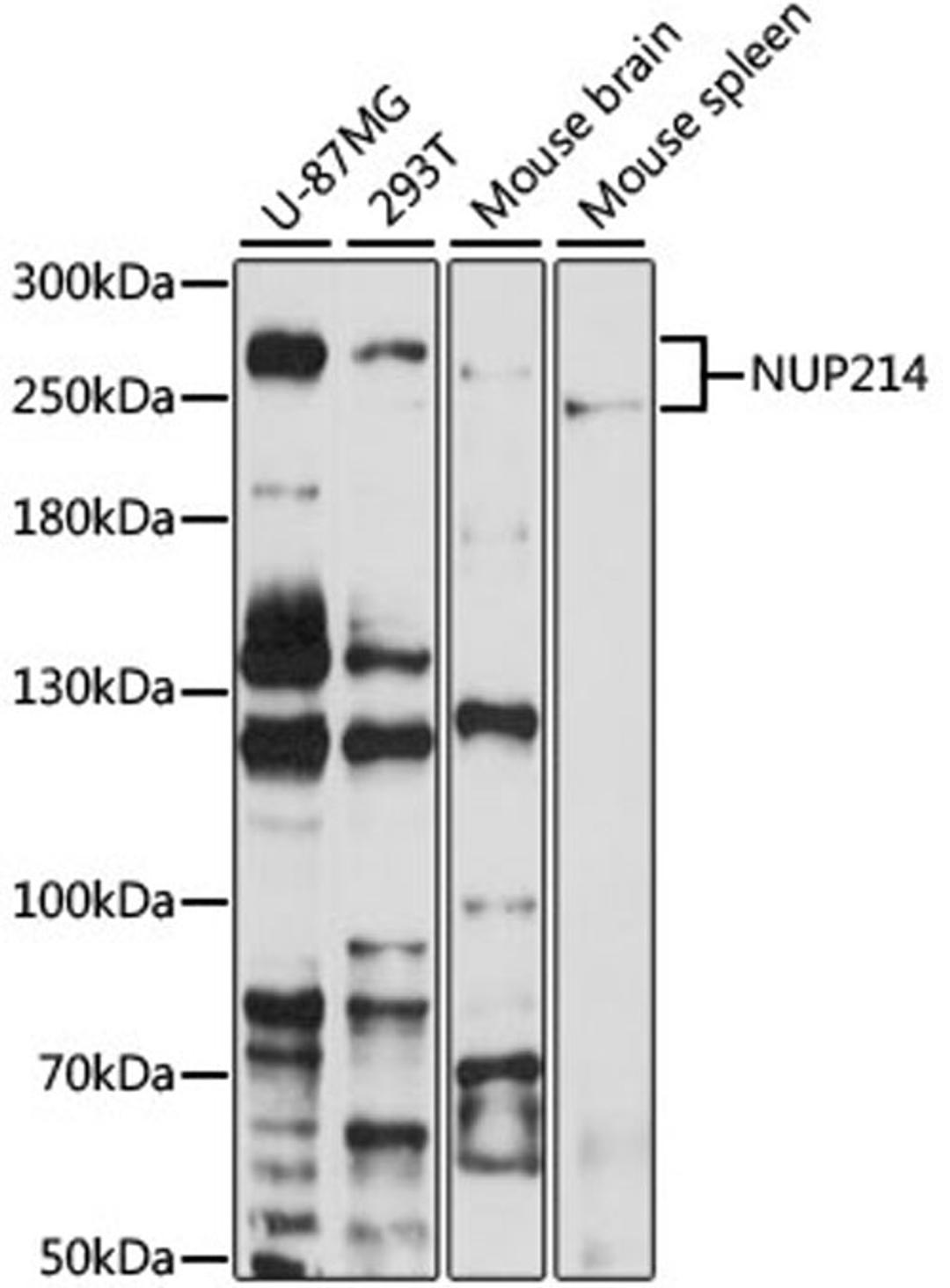 Western blot - NUP214 antibody (A8357)