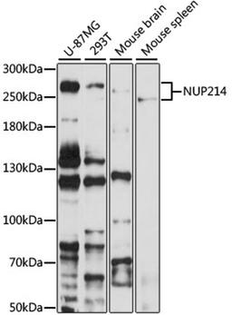 Western blot - NUP214 antibody (A8357)