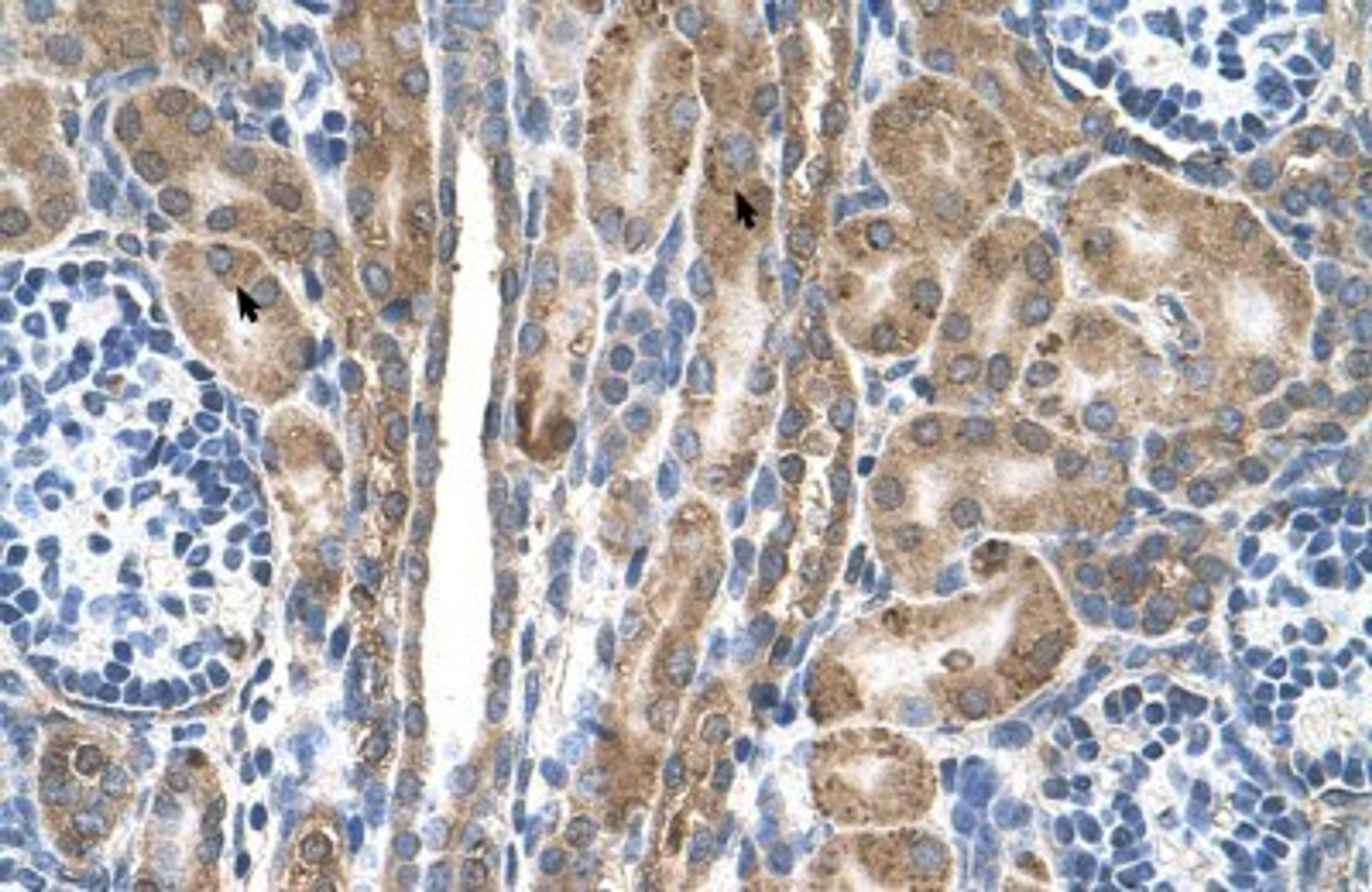 Immunohistochemistry-Paraffin: FAM55D Antibody [NBP1-80545] - Human kidney Tissue, antibody concentration 4-8ug/ml. Cells with positive label: renal corpuscle cells (indicated with arrows) 400X magnification.