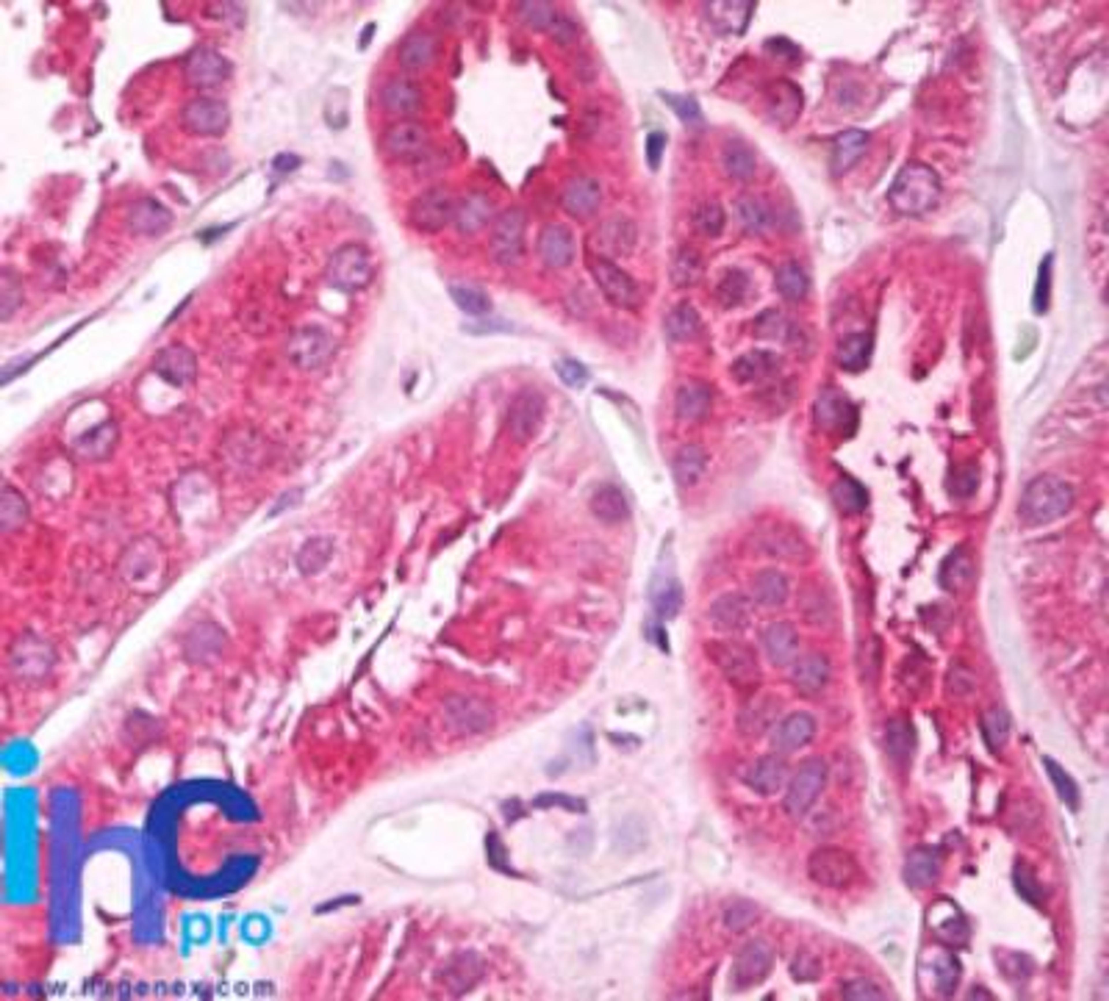 Immunohistochemistry-Paraffin: UNC5CL Antibody [NBP2-24576] - Formalin-fixed, paraffin-embedded human kidney stained with UNC5CL antibody at 5 ug/ml. Staining of formalin-fixed tissues is enhanced by boiling tissue sections in 10 mM sodium citrate buffer, pH 6.0 for 10-20 min followed by cooling at RT for 20 min.